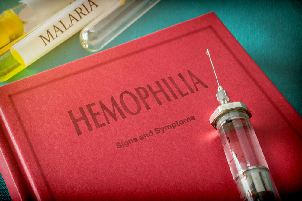 Risk Factors of Hemophilia